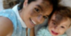 #Foto Para celebrar la singularidad, se maquilla en la cara la mancha de su hijo