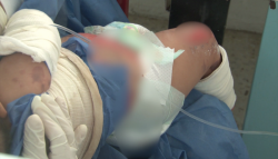 Niños mazatlecos quemados son trasladados a Estados Unidos