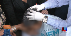 En Cajeme, Jurisdicción Sanitaria #4 llama a cuidar a los niños de los piojos