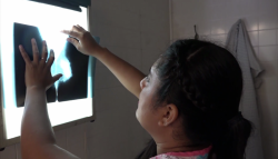 Detectan nuevos casos de cáncer de mama en la zona sur del estado