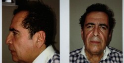Muere Héctor Beltrán Leyva, víctima de un infarto cardíaco
