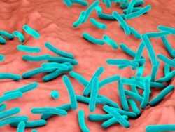En Sinaloa siguen detectándose casos de lepra: Dermatólogo