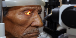Glaucoma, principal causa de ceguera