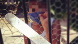 DIF protege y resguarda a niño quemado por su mamá