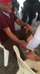 Atienden a persona por picadura de mantarraya