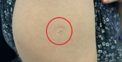 ¿Sabes por qué tenemos esta cicatriz en el brazo?