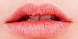 Señales de que tus labios resecos podrían ser un problema grave