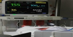 Nacen cuatrillizos en el Hospital de la Mujer
