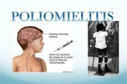 En México no hay casos de poliomielitis