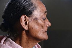En 23 años, más de 66 mil personas de escasos recursos beneficiadas con Jornadas Quirúrgicas Bienestar