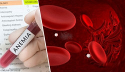 Anemia es una enfermedad muy común en la población