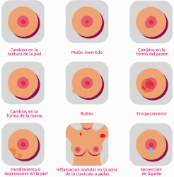Es necesario  chequeo constante en mujeres para prevenir cáncer de mama