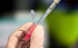 Oxford ya produce vacunas de Covid-19 para venderlas en diciembre una vez probadas