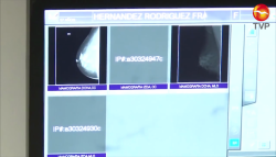 Hay hábitos que se pueden cambiar para disminuir la incidencia del cáncer de mama