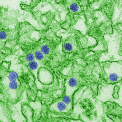 Flavivirus: golpean más fuerte la segunda vez