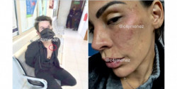 Trasladan a Eleazar Gómez al Reclusorio Sur de la CDMX por tratar de estrangular a su novia