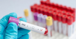 Vacuna de Janssen contra el VIH ha iniciado la fase 3 de pruebas
