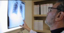 Cajeme y Guaymas, con más casos de tuberculosis en la JSN4