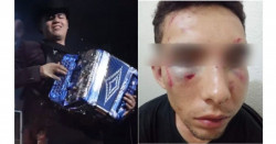 Remmy Valenzuela es denunciado por dar golpiza a su primo y azotar con cables a su novia