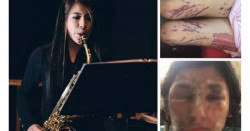 Ordenan arrestar a hijo de exdiputado por ataque con ácido a saxofonista en 2019