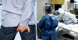 Hombre desarrolla "síndrome del ano inquieto" después de hospitalizarse por Covid-19
