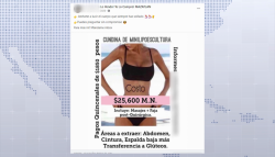 Especialistas piden no dejarse llevar por "bajos costos" de cirugías estéticas