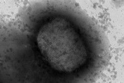 Sin reportes en la región del virus del mono