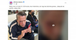 Dieron golpiza a Adame por querer grabar a víctimas de homicidio